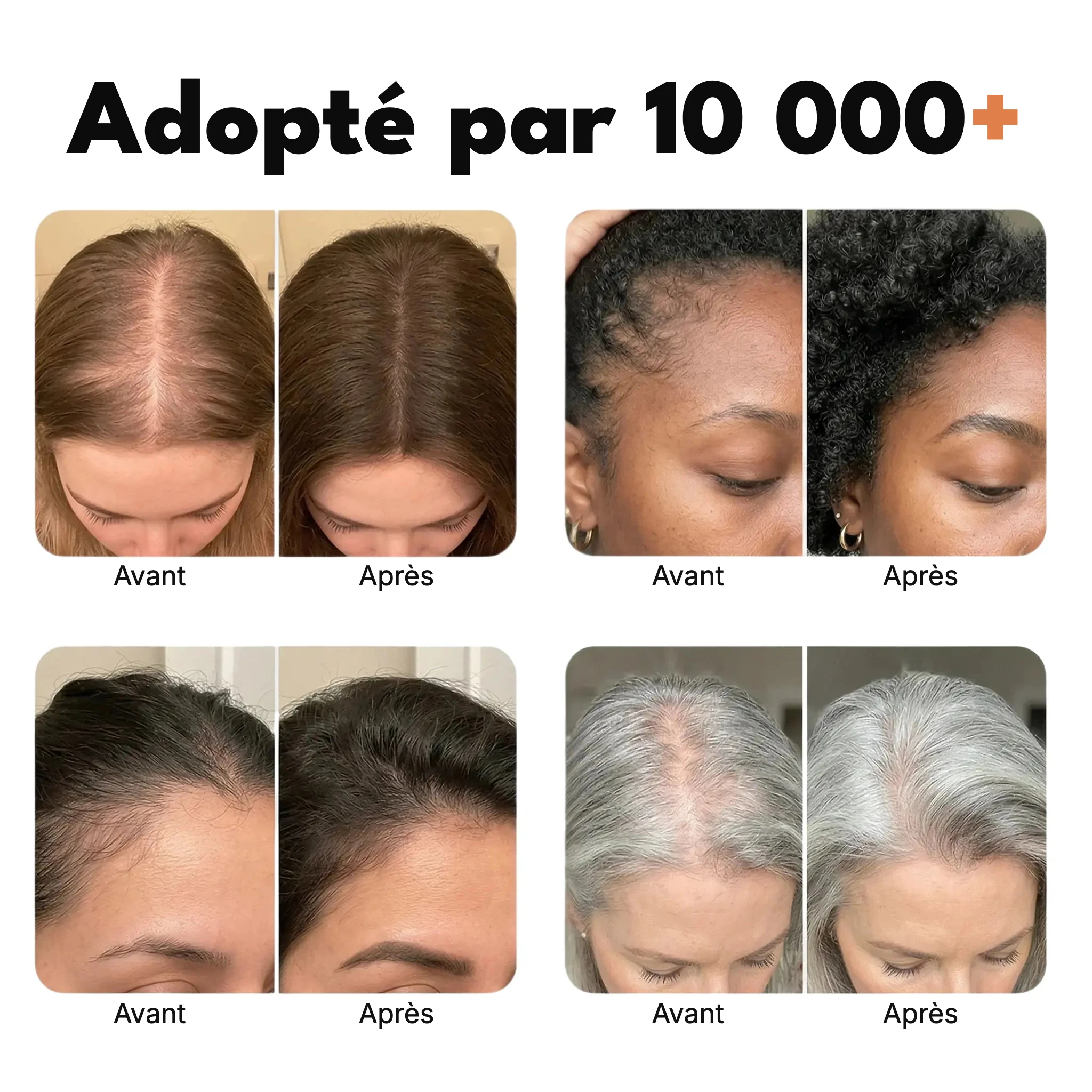 Sérum pousse des cheveux n° 1 en Corée — image 2