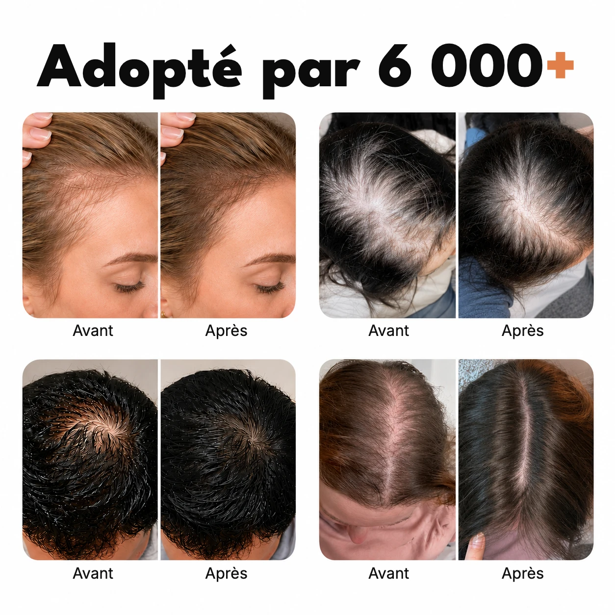 Shampoing pousse des cheveux n° 1 en Corée — image 2