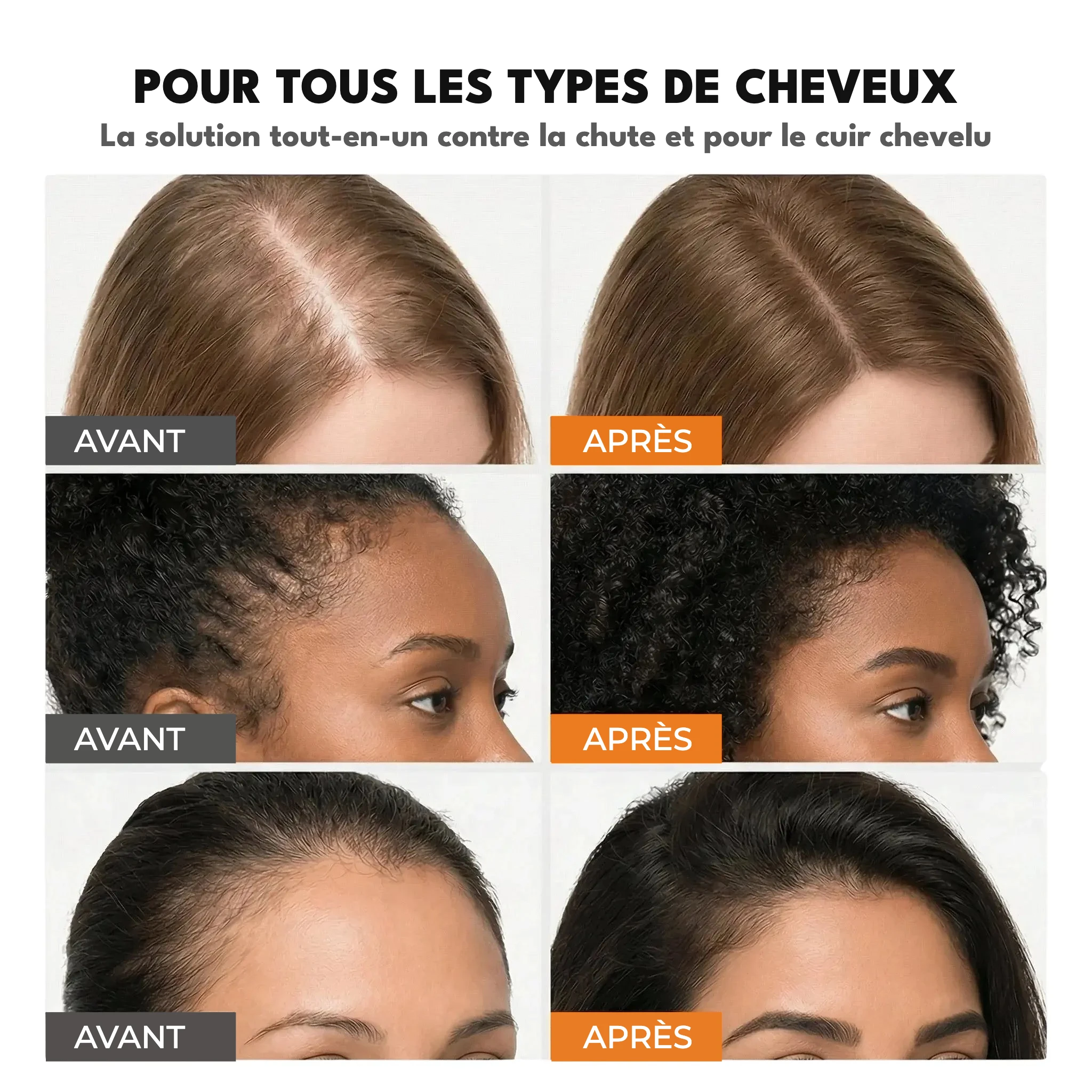 Sérum pousse des cheveux n° 1 en Corée — image 5